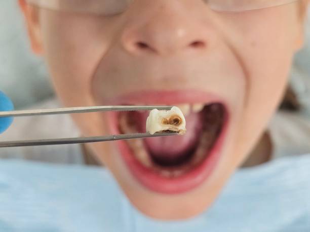 Best Emergency Broken Tooth Repair in North Randall, OH
