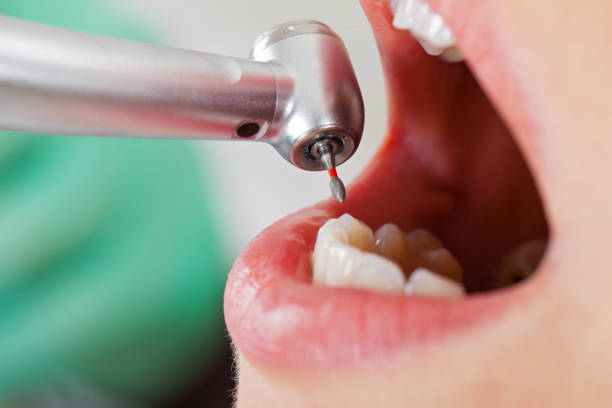 Best Pediatric Emergency Dentist in North Randall, OH